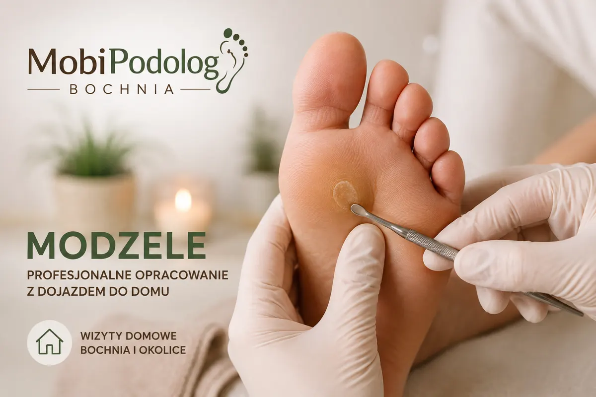 Modzele - podolog Bochnia modzele podolog Bochnia - mobilny podolog z dojazdem